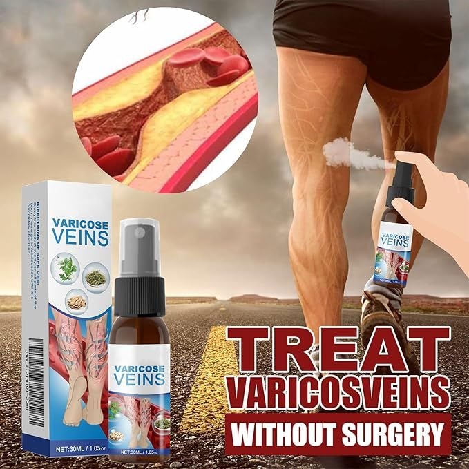Varicose Vein Spray Herbal Body Care for Vasculitis And Phlebitis Relief